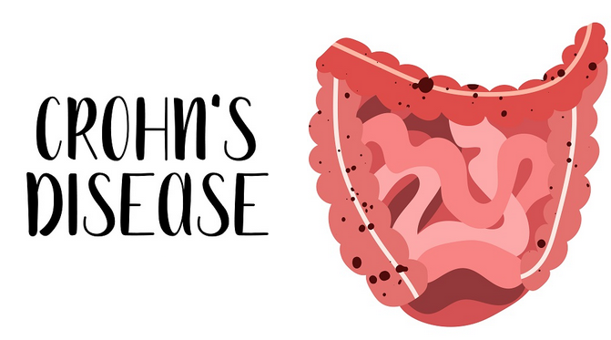 Crohn's Disease Cartoon